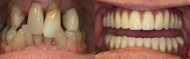 Dr. Jennifer Wallace. Palmetto Smiles of Beaufort. TMD, TMJ, Clear Aligners (SureSmile + Invisalign), Dental Implants, Sleep Apnea, Childrens Dentistry, Cosmetic Dentistry, Restorative Dentistry, General, Cosmetic, Restorative, Emergency Dentistry. Dentist in Beaufort, SC 29907