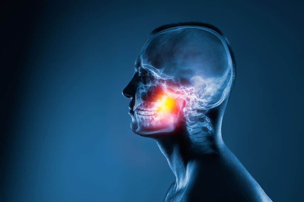 Can Jaw Joint Pain Cause Headaches?