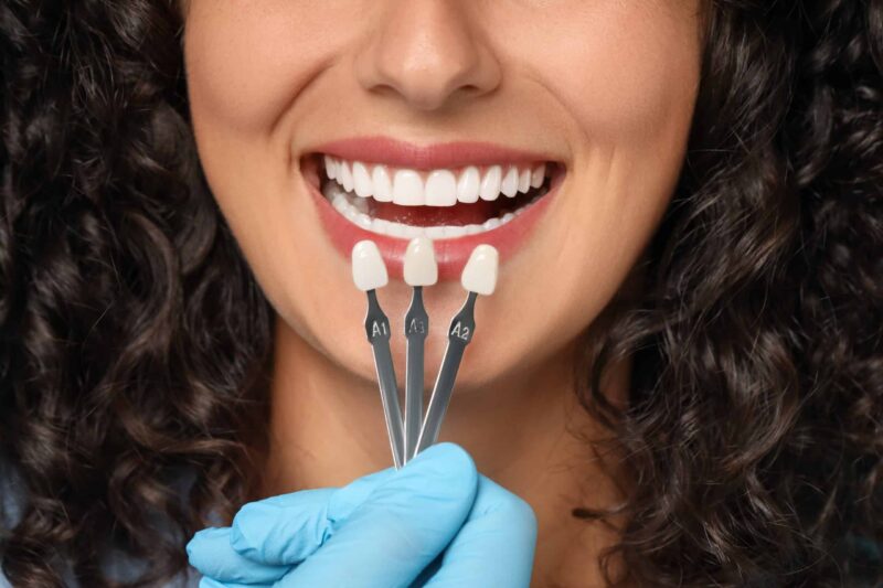 It’s Time To Know The Truth About Cosmetic Dentistry in Beaufort