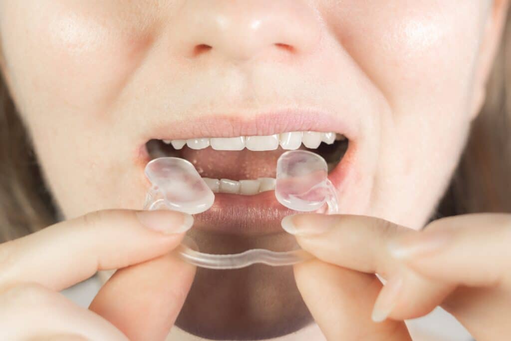 Why Choose Palmetto Smiles for TMD Treatment in Beaufort, SC?