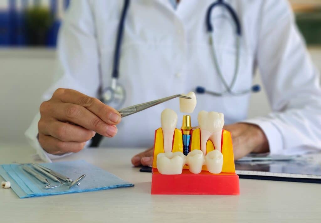Why Summer is the Perfect Time for Dental Implants in Beaufort  